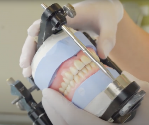 Kunstgebit aanmeten | Deurne | Eerenbeemt | Robin |